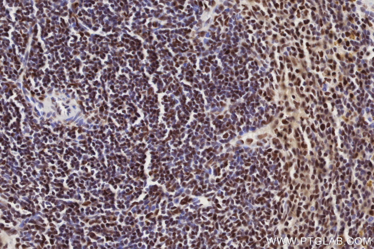Immunohistochemical analysis of paraffin-embedded mouse spleen tissue slide using KHC2865 (MTA3 IHC Kit).