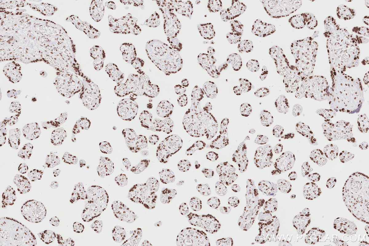 Immunohistochemical analysis of paraffin-embedded human placenta tissue slide using KHC2865 (MTA3 IHC Kit).