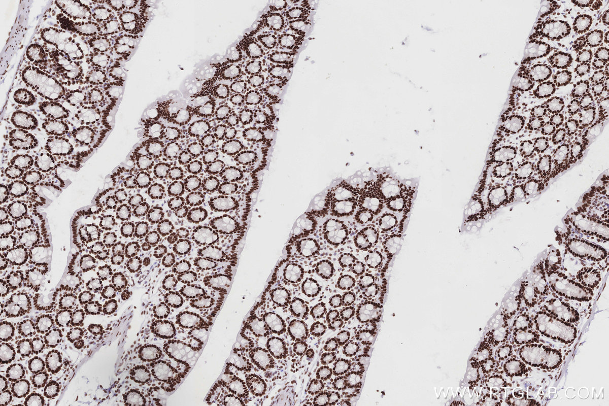 Immunohistochemical analysis of paraffin-embedded mouse colon tissue slide using KHC2865 (MTA3 IHC Kit).