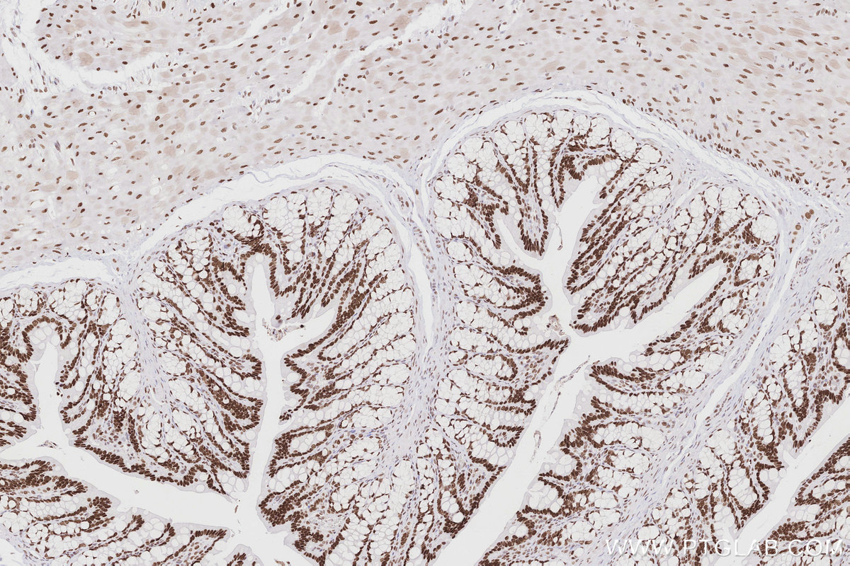 Immunohistochemical analysis of paraffin-embedded rat colon tissue slide using KHC2865 (MTA3 IHC Kit).