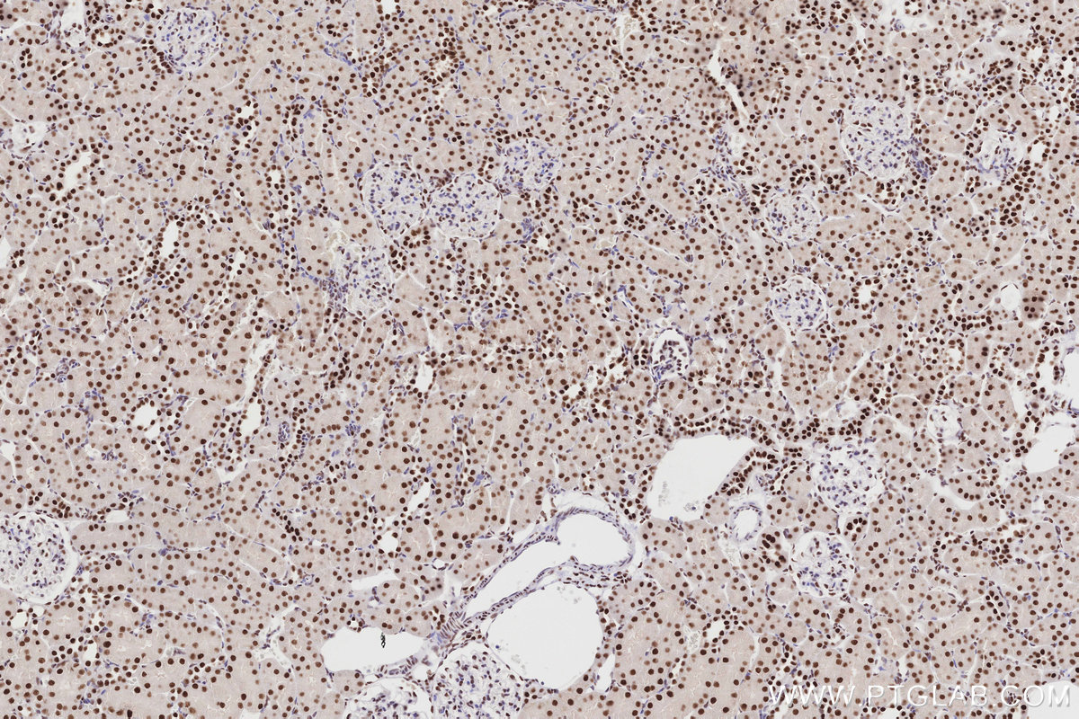 Immunohistochemical analysis of paraffin-embedded rat kidney tissue slide using KHC2865 (MTA3 IHC Kit).