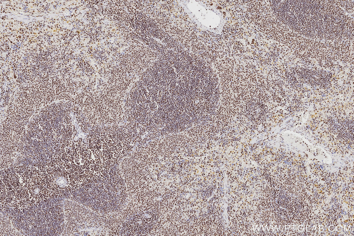 Immunohistochemical analysis of paraffin-embedded rat spleen tissue slide using KHC2865 (MTA3 IHC Kit).