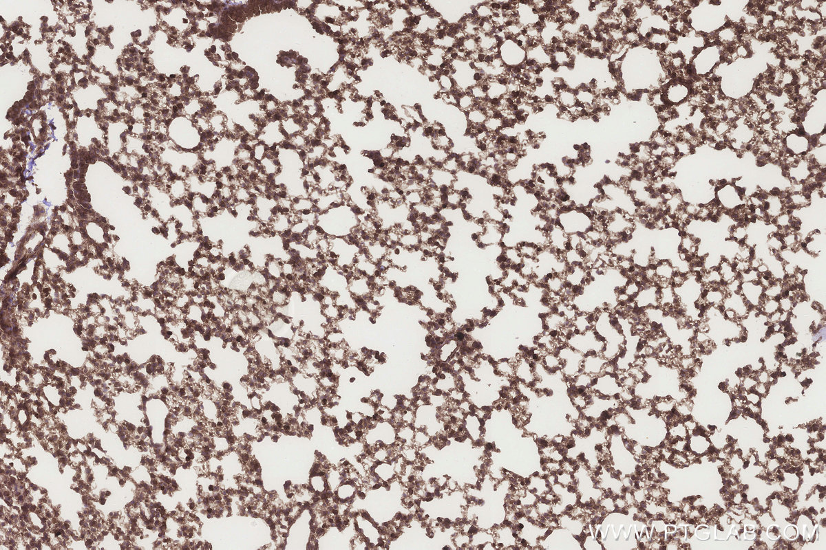 Immunohistochemical analysis of paraffin-embedded mouse lung tissue slide using KHC3265 (MTARC1/MOSC1 IHC Kit). Immunohistochemical analysis of paraffin-embedded mouse lung tissue slide using KHC3265 (MTARC1/MOSC1 IHC Kit).