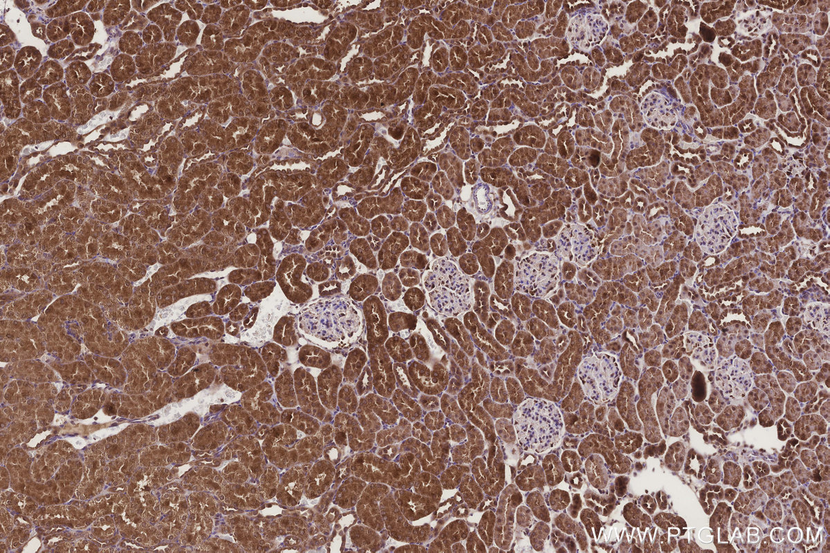 Immunohistochemical analysis of paraffin-embedded rat kidney tissue slide using KHC3265 (MTARC1/MOSC1 IHC Kit). Immunohistochemical analysis of paraffin-embedded rat kidney tissue slide using KHC3265 (MTARC1/MOSC1 IHC Kit).
