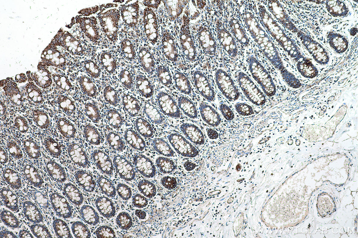Immunohistochemical analysis of paraffin-embedded human colon tissue slide using KHC0575 (MTCO2 IHC Kit).