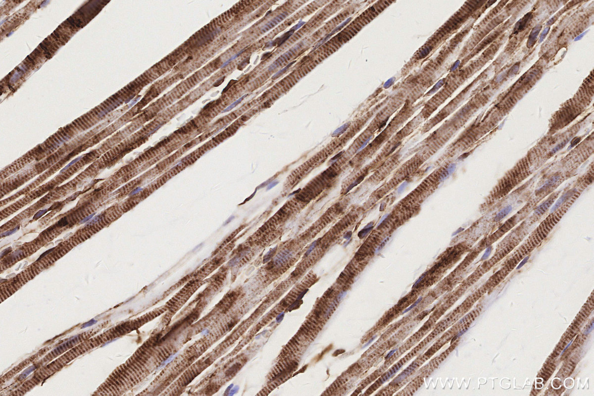Immunohistochemical analysis of paraffin-embedded rat heart tissue slide using KHC3160 (MTCO3 IHC Kit). Immunohistochemical analysis of paraffin-embedded rat heart tissue slide using KHC3160 (MTCO3 IHC Kit).