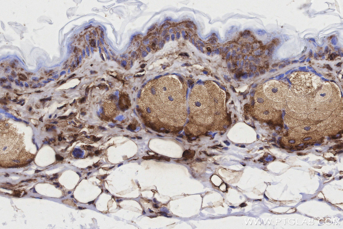 Immunohistochemical analysis of paraffin-embedded mouse skin tissue slide using KHC3160 (MTCO3 IHC Kit). Immunohistochemical analysis of paraffin-embedded mouse skin tissue slide using KHC3160 (MTCO3 IHC Kit).