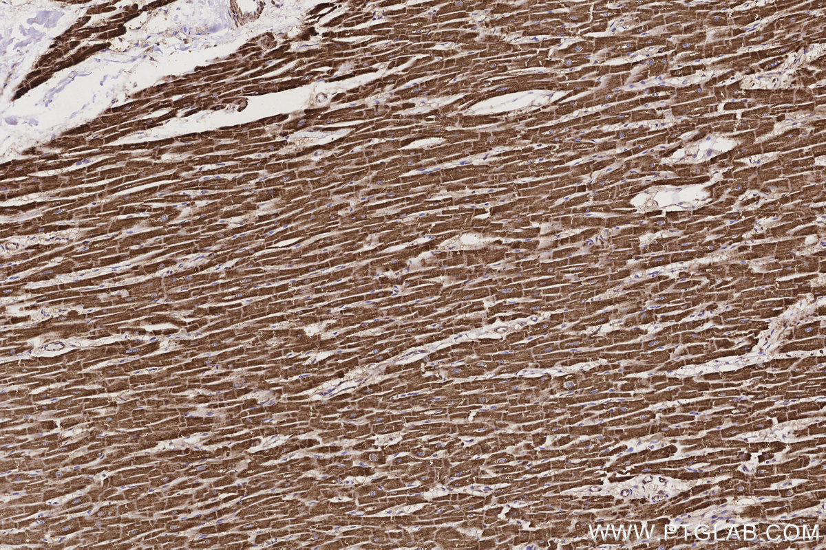Immunohistochemical analysis of paraffin-embedded human heart tissue slide using KHC3160 (MTCO3 IHC Kit). Immunohistochemical analysis of paraffin-embedded human heart tissue slide using KHC3160 (MTCO3 IHC Kit).