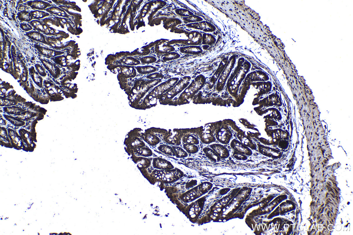 Immunohistochemical analysis of paraffin-embedded mouse colon tissue slide using KHC1366 (MTDH IHC Kit).