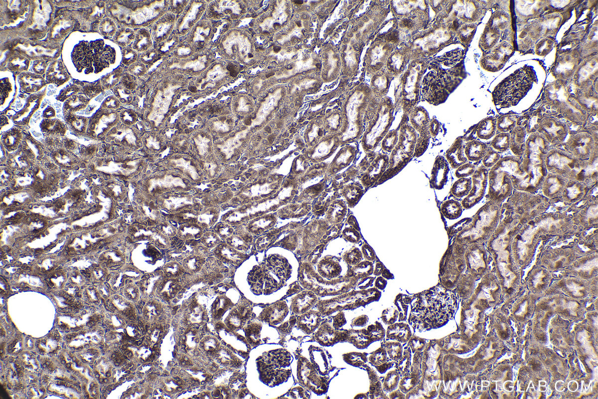 Immunohistochemical analysis of paraffin-embedded rat kidney tissue slide using KHC1366 (MTDH IHC Kit).