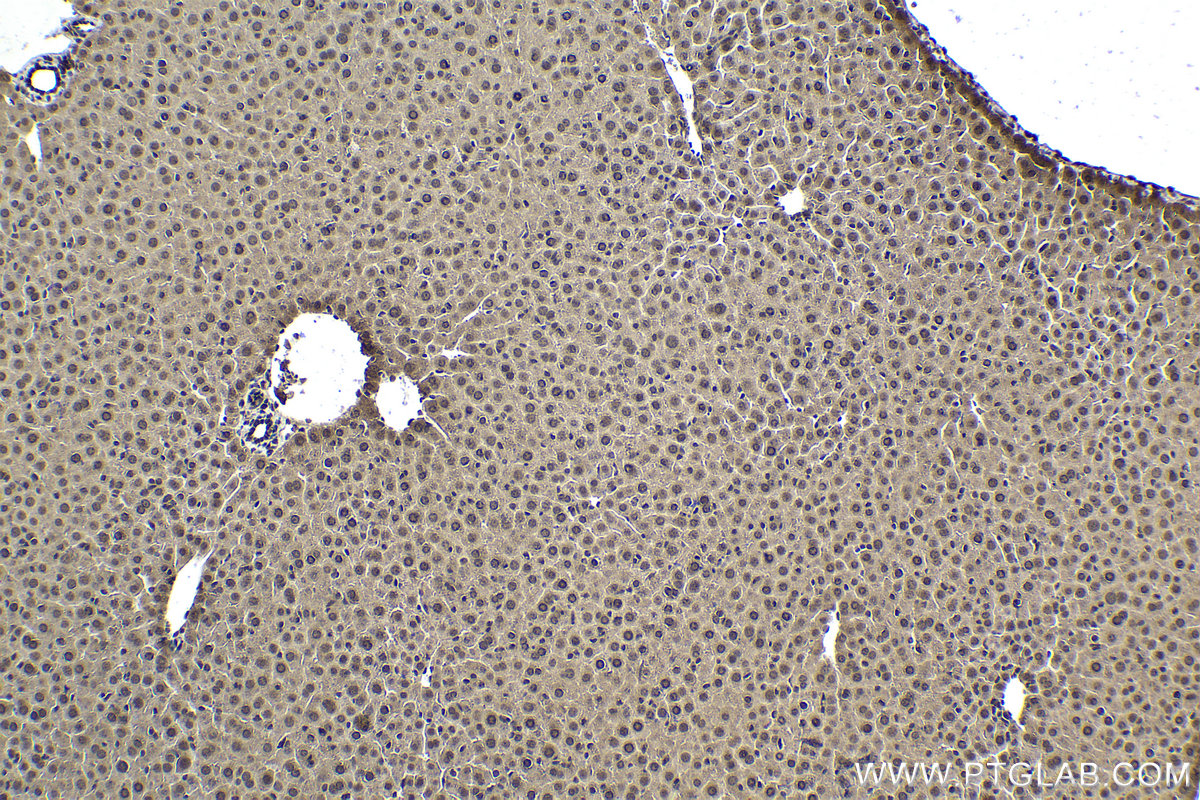 Immunohistochemical analysis of paraffin-embedded mouse liver tissue slide using KHC1738 (MTF1 IHC Kit).