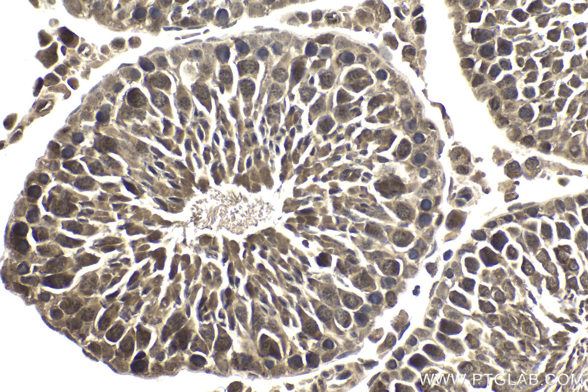 Immunohistochemical analysis of paraffin-embedded rat testis tissue slide using KHC1738 (MTF1 IHC Kit).