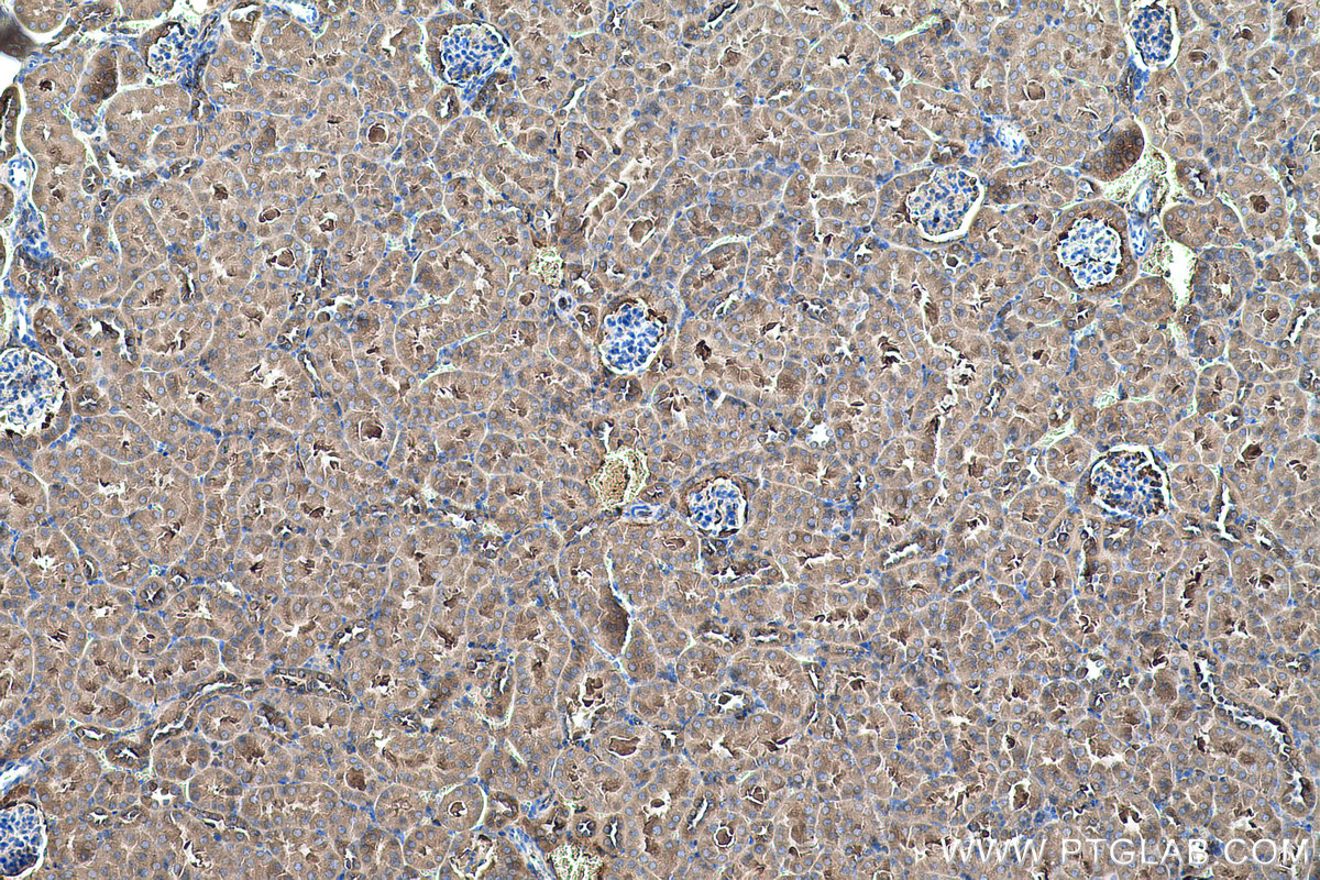 Immunohistochemical analysis of paraffin-embedded mouse kidney tissue slide using KHC0578 (MTHFD1 IHC Kit).