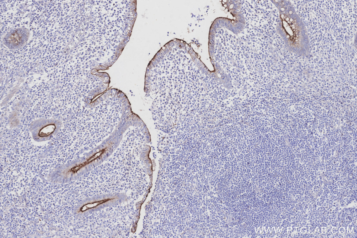 Immunohistochemical analysis of paraffin-embedded human appendicitis tissue slide using KHC2912 (MUC13 IHC Kit).