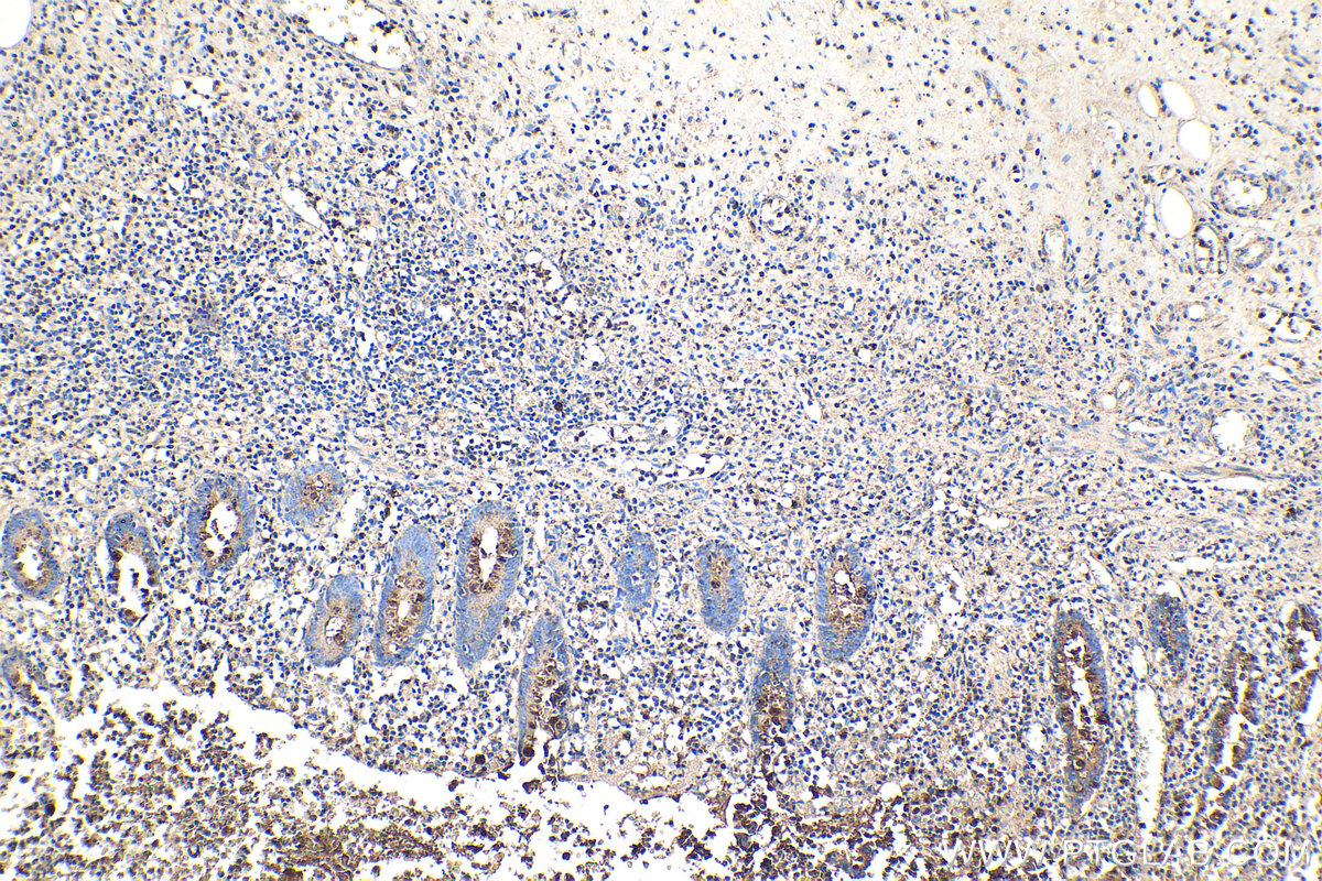 Immunohistochemical analysis of paraffin-embedded human appendicitis tissue slide using KHC1327 (MUC2 IHC Kit).