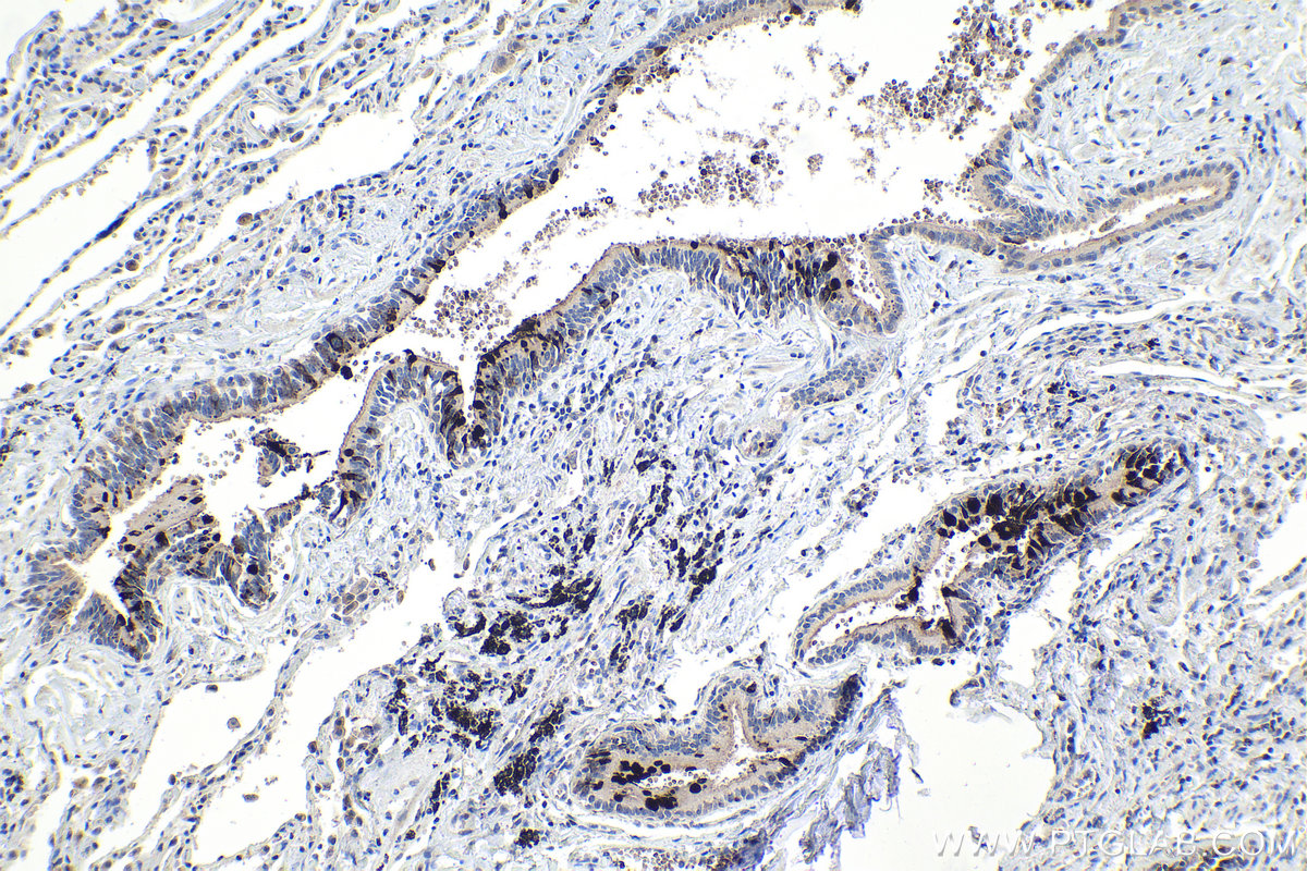 Immunohistochemical analysis of paraffin-embedded human lung tissue slide using KHC1093 (MUC5B IHC Kit).