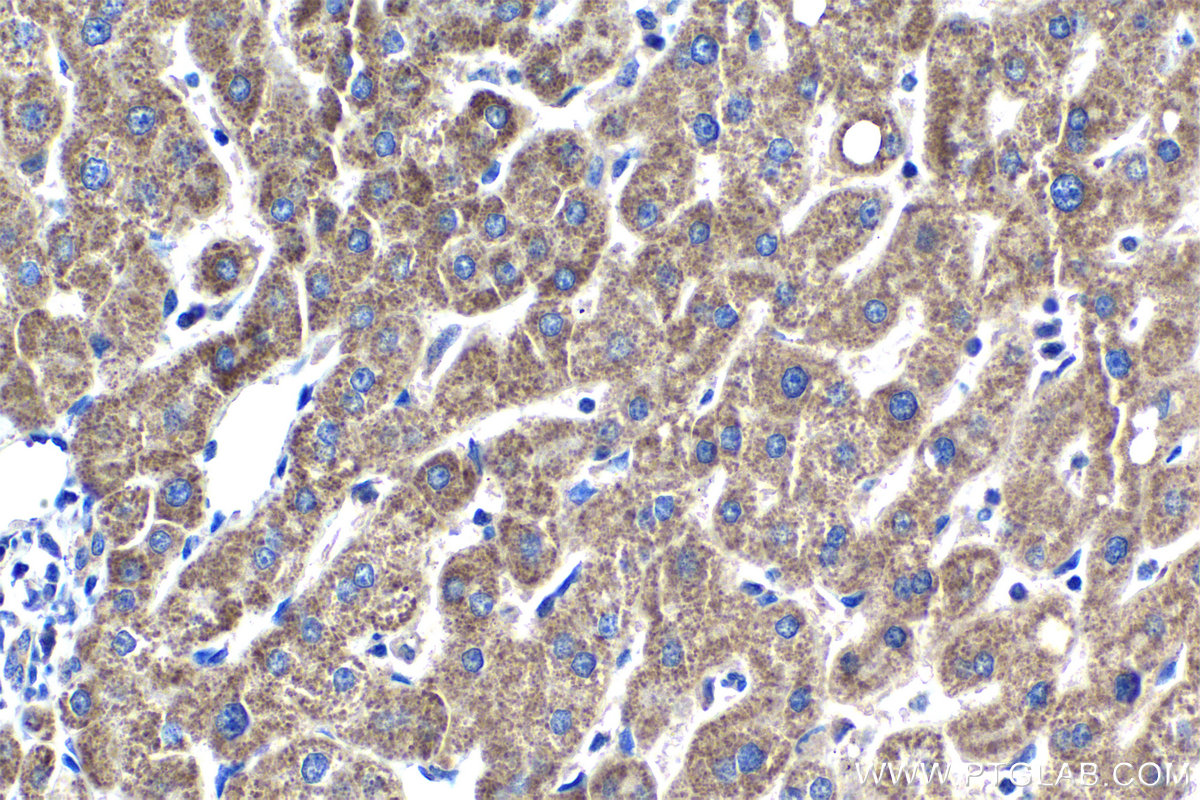Immunohistochemical analysis of paraffin-embedded human liver tissue slide using KHC1021 (MUT IHC Kit).