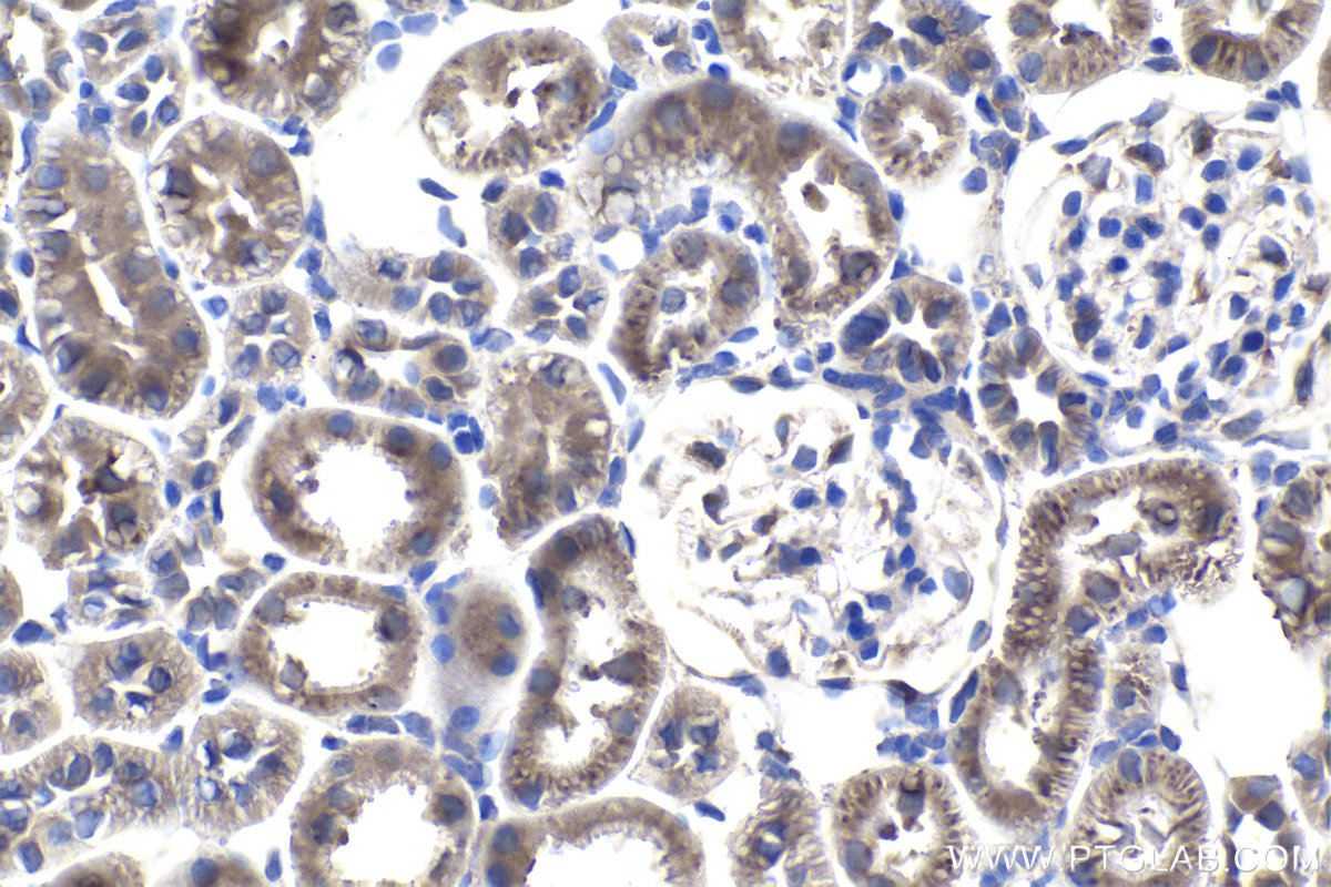 Immunohistochemical analysis of paraffin-embedded rat kidney tissue slide using KHC1021 (MUT IHC Kit).