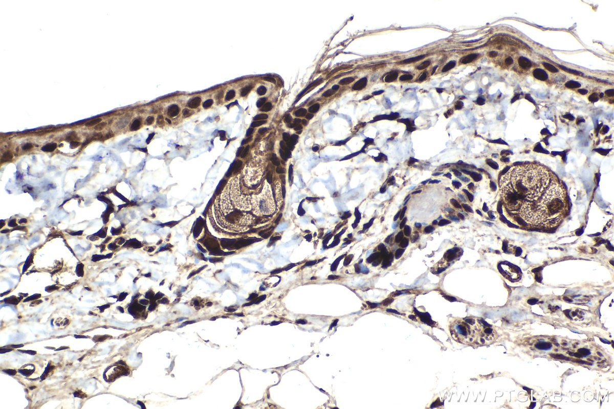 Immunohistochemical analysis of paraffin-embedded rat skin tissue slide using KHC2116 (MYCBP2 IHC Kit).