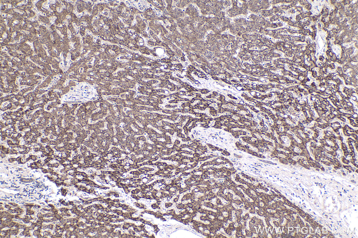 Immunohistochemical analysis of paraffin-embedded human liver tissue slide using KHC1924 (MYD88 IHC Kit).