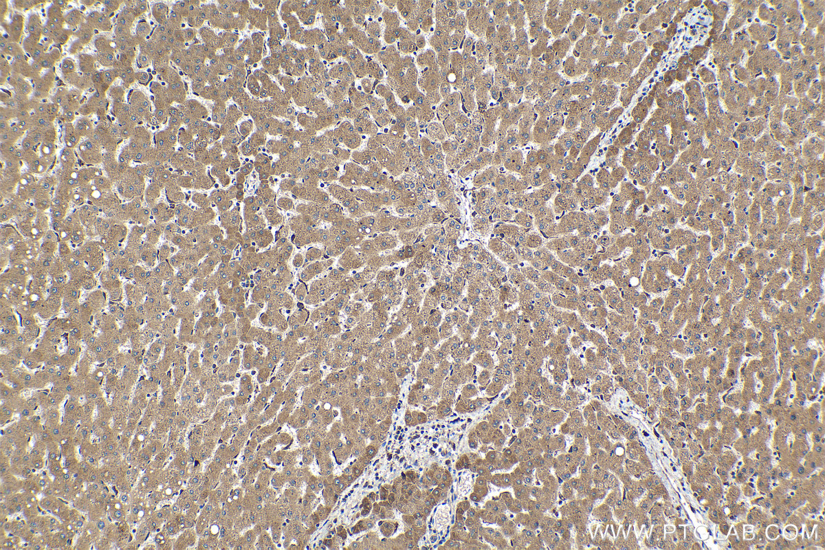 Immunohistochemical analysis of paraffin-embedded human liver tissue slide using KHC1139 (MYDGF IHC Kit).