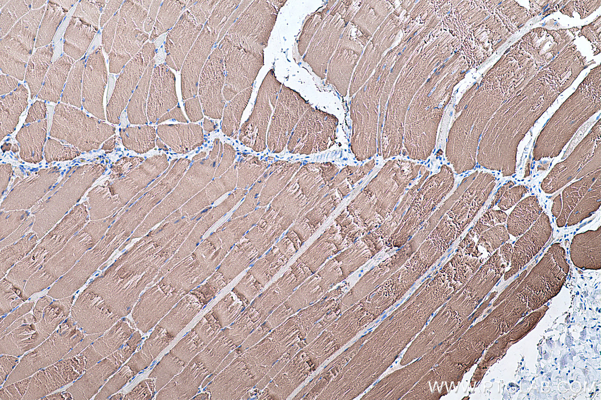 Immunohistochemical analysis of paraffin-embedded rat skeletal muscle tissue slide using KHC0364 (MYH1 IHC Kit).