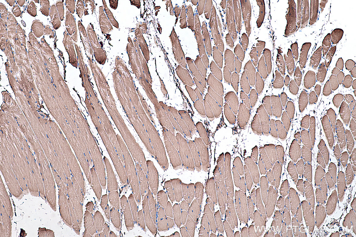 Immunohistochemical analysis of paraffin-embedded mouse skeletal muscle tissue slide using KHC0364 (MYH1 IHC Kit).