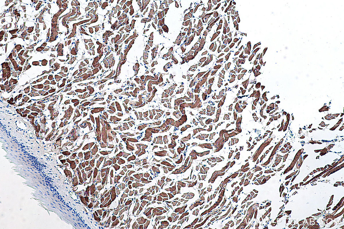 Immunohistochemical analysis of paraffin-embedded mouse tongue tissue slide using KHC0364 (MYH1 IHC Kit).