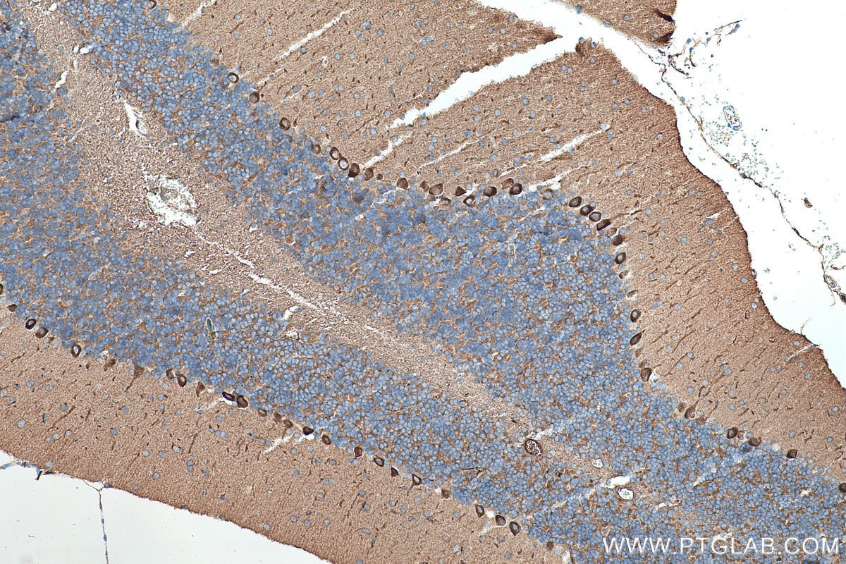 Immunohistochemical analysis of paraffin-embedded mouse cerebellum tissue slide using KHC0346 (MYH10 IHC Kit).