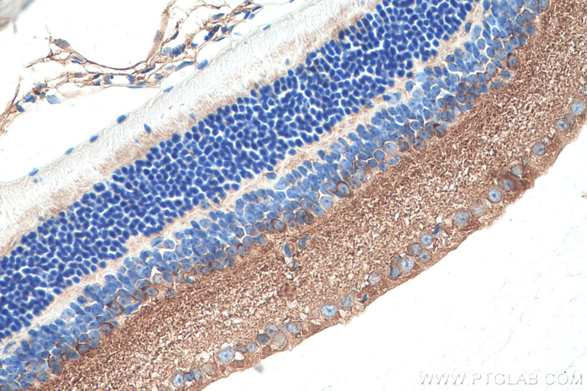 Immunohistochemical analysis of paraffin-embedded mouse eye tissue slide using KHC0346 (MYH10 IHC Kit).