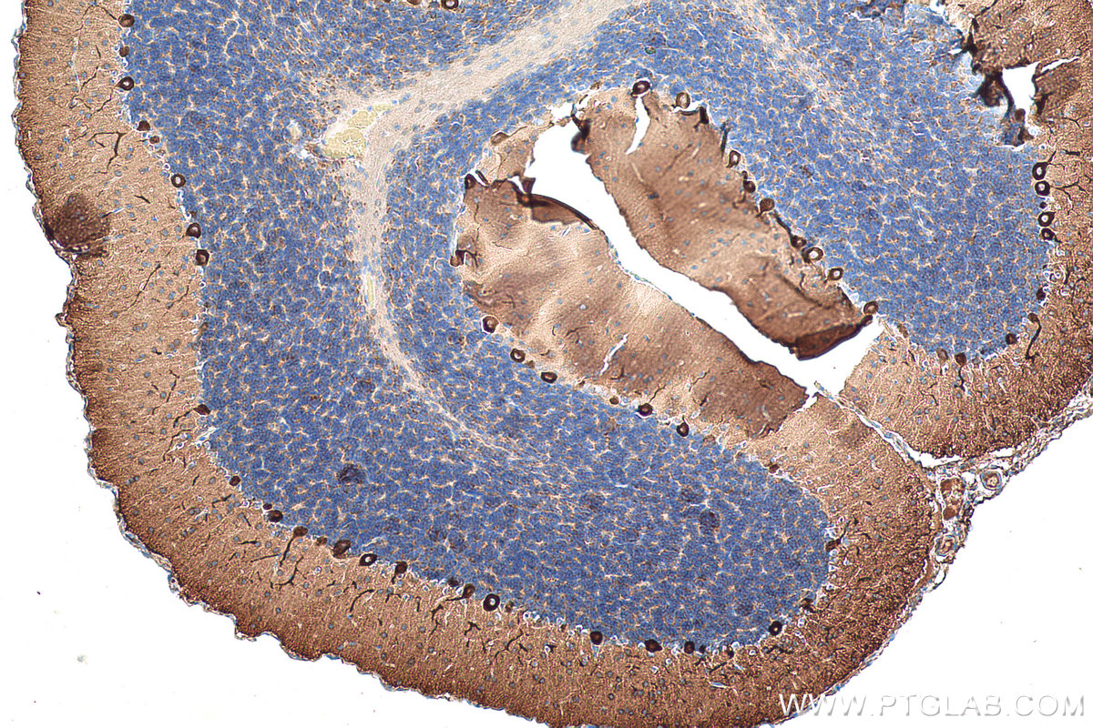 Immunohistochemical analysis of paraffin-embedded rat cerebellum tissue slide using KHC0346 (MYH10 IHC Kit).