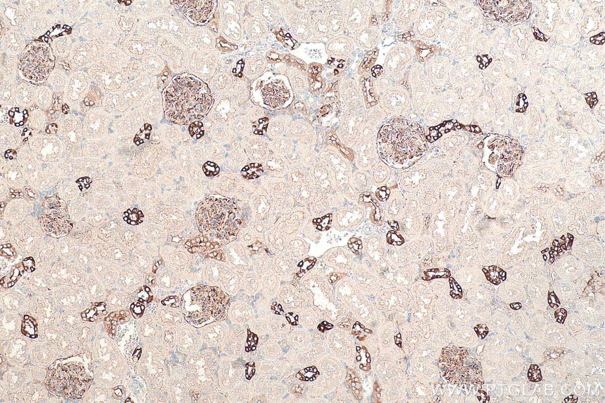 Immunohistochemical analysis of paraffin-embedded rat kidney tissue slide using KHC0346 (MYH10 IHC Kit).