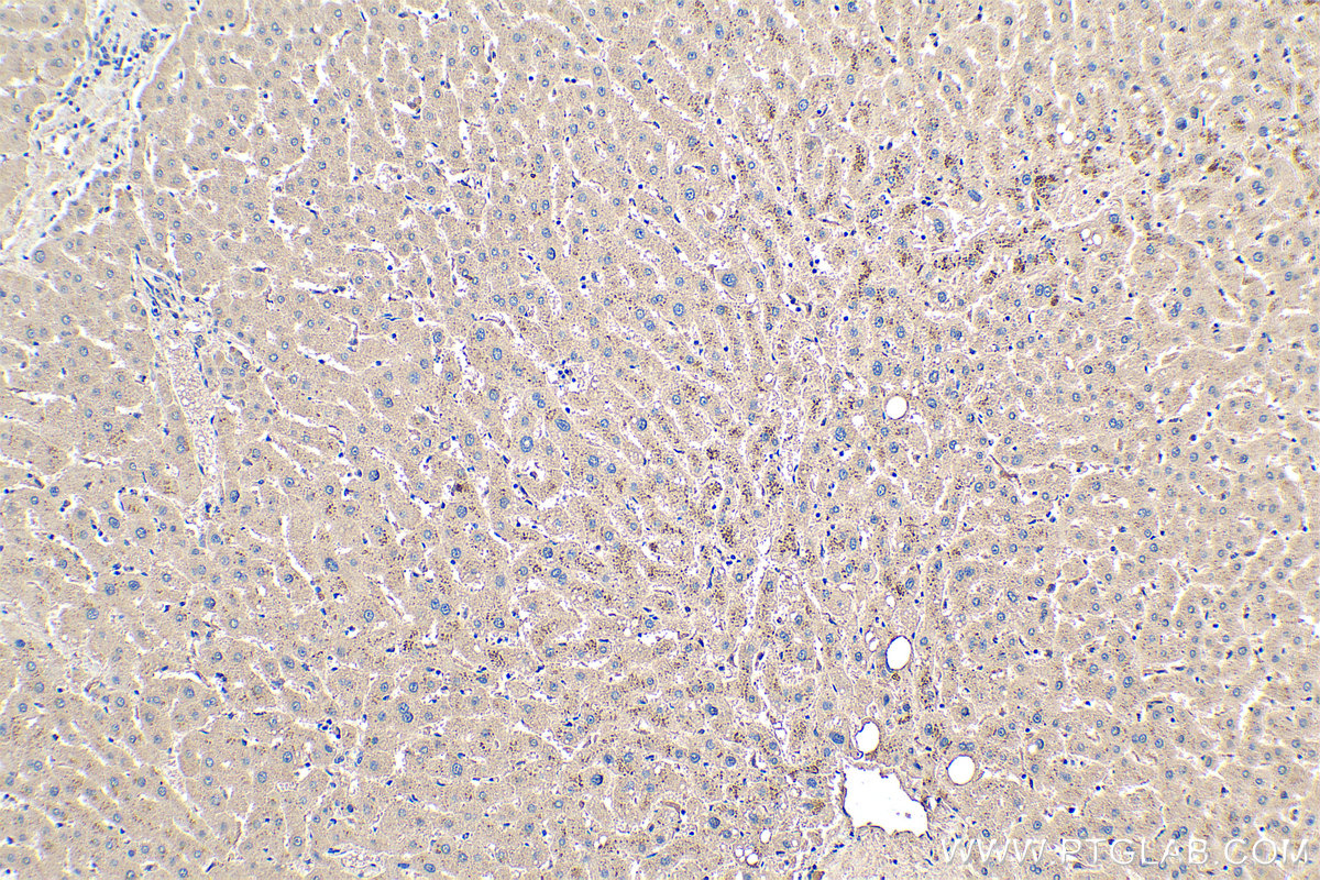 Immunohistochemical analysis of paraffin-embedded human liver tissue slide using KHC0351 (MYH14 IHC Kit).