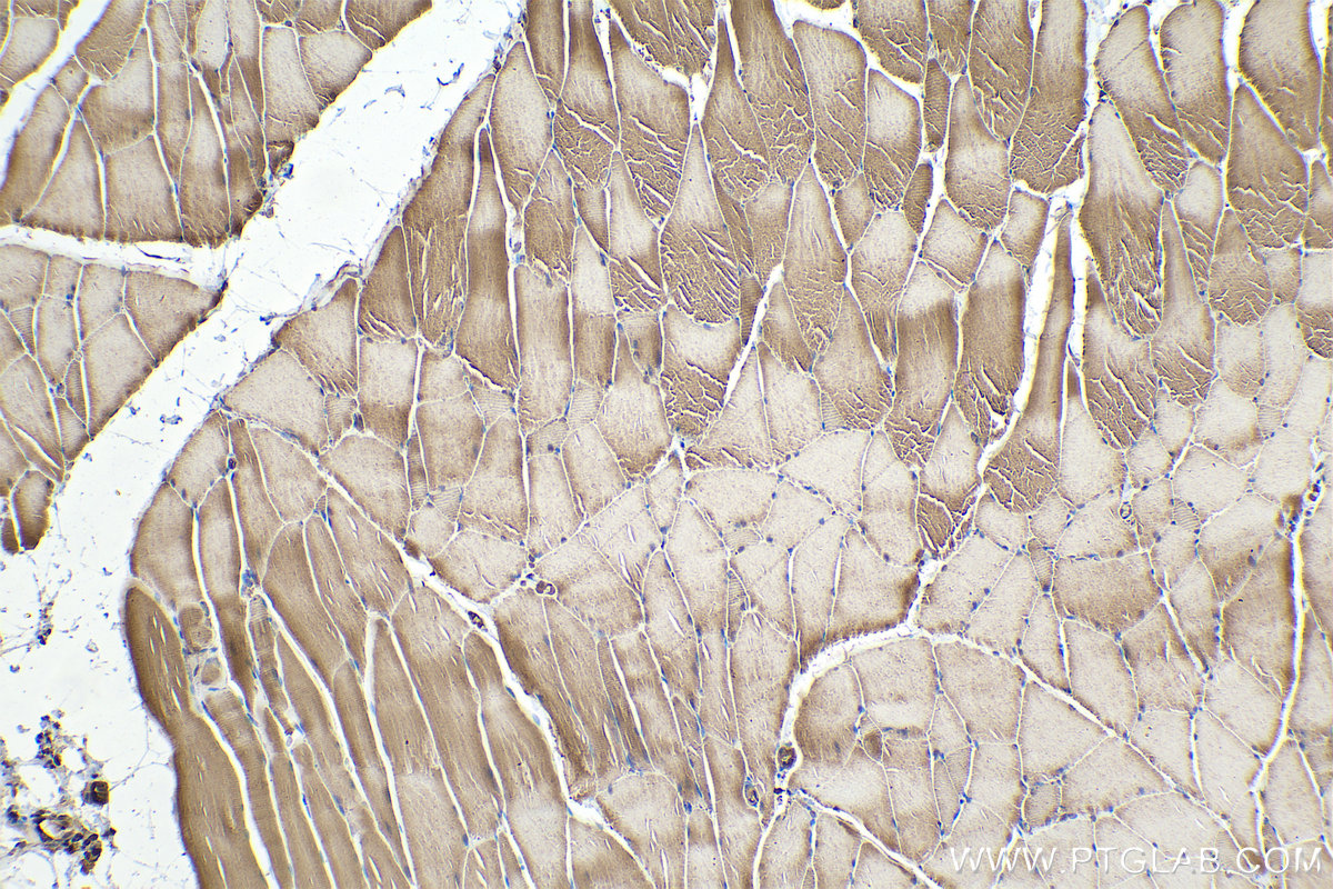 Immunohistochemical analysis of paraffin-embedded rat skeletal muscle tissue slide using KHC0337 (MYH3 IHC Kit).
