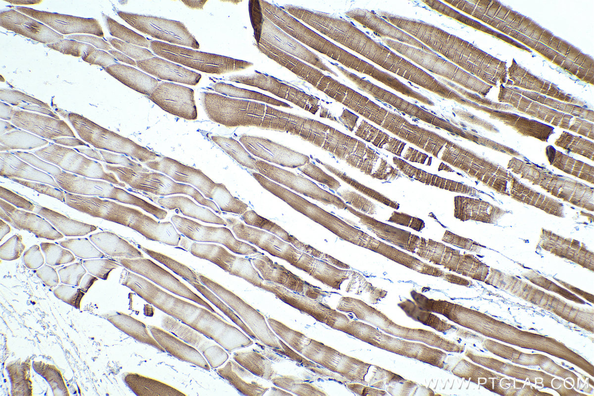 Immunohistochemical analysis of paraffin-embedded rat skeletal muscle tissue slide using KHC0339 (MYH4 IHC Kit).