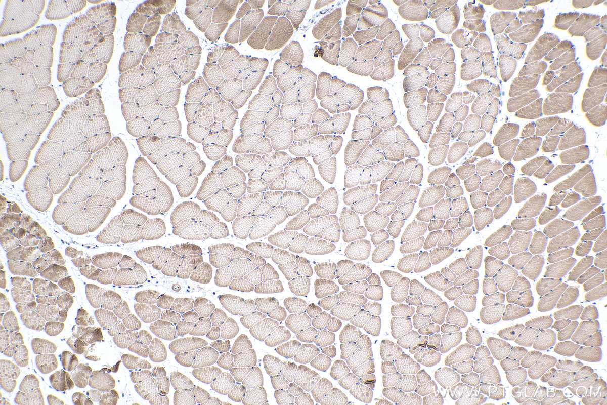 Immunohistochemical analysis of paraffin-embedded mouse skeletal muscle tissue slide using KHC0339 (MYH4 IHC Kit).