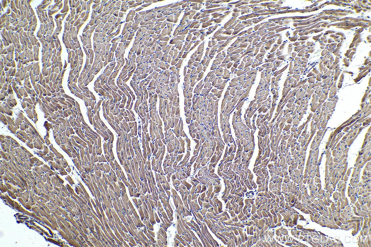 Immunohistochemical analysis of paraffin-embedded mouse heart tissue slide using KHC0341 (MYH6 IHC Kit).