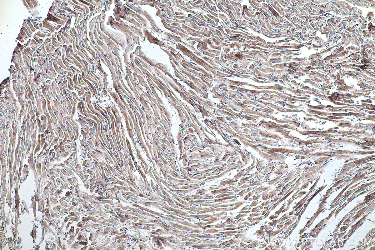 Immunohistochemical analysis of paraffin-embedded mouse heart tissue slide using KHC0343 (MYH7 IHC Kit).