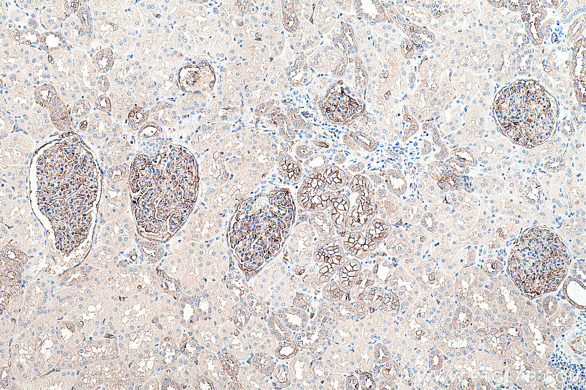 Immunohistochemical analysis of paraffin-embedded human kidney tissue slide using KHC0365 (MYH9 IHC Kit).