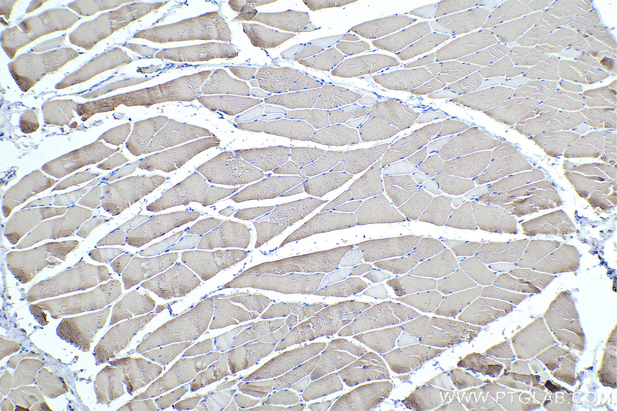 Immunohistochemical analysis of paraffin-embedded rat skeletal muscle tissue slide using KHC0335 (MYL1 IHC Kit).