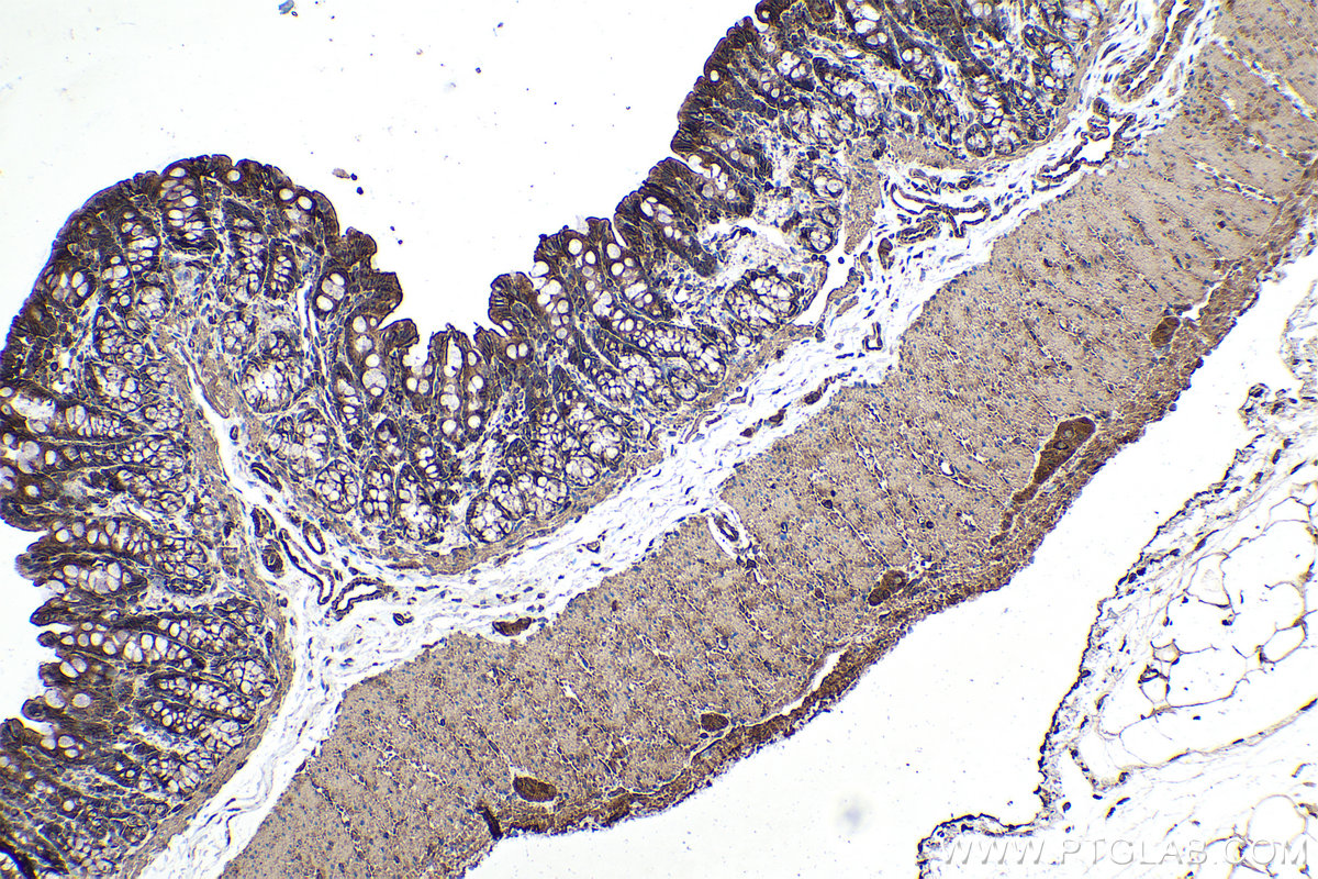 Immunohistochemical analysis of paraffin-embedded rat colon tissue slide using KHC0349 (MYL12B IHC Kit).