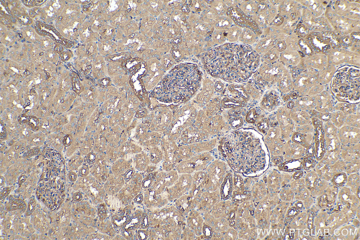 Immunohistochemical analysis of paraffin-embedded human kidney tissue slide using KHC0349 (MYL12B IHC Kit).