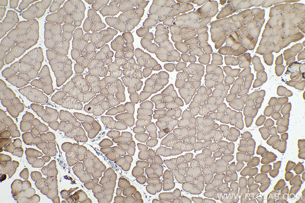 Immunohistochemical analysis of paraffin-embedded mouse skeletal muscle tissue slide using KHC0338 (MYL3 IHC Kit).