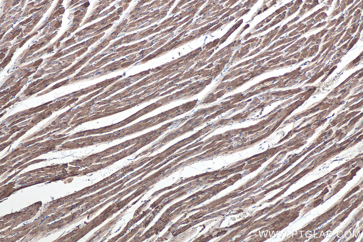 Immunohistochemical analysis of paraffin-embedded rat heart tissue slide using KHC0342 (MYL6 IHC Kit).