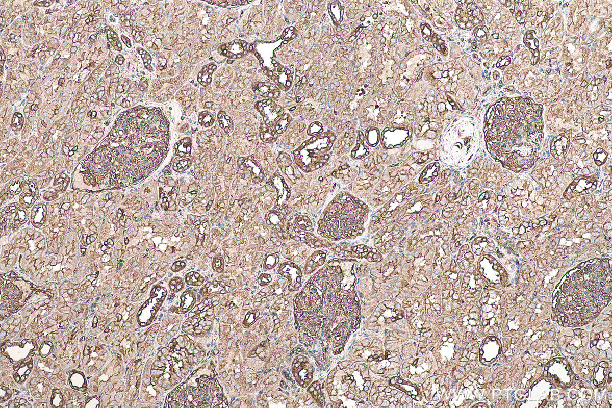 Immunohistochemical analysis of paraffin-embedded human kidney tissue slide using KHC0342 (MYL6 IHC Kit).