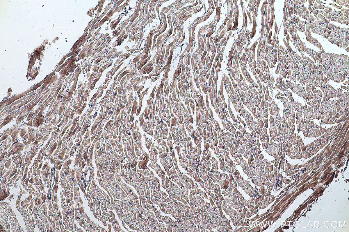 Immunohistochemical analysis of paraffin-embedded mouse heart tissue slide using KHC0344 (MYL7 IHC Kit).