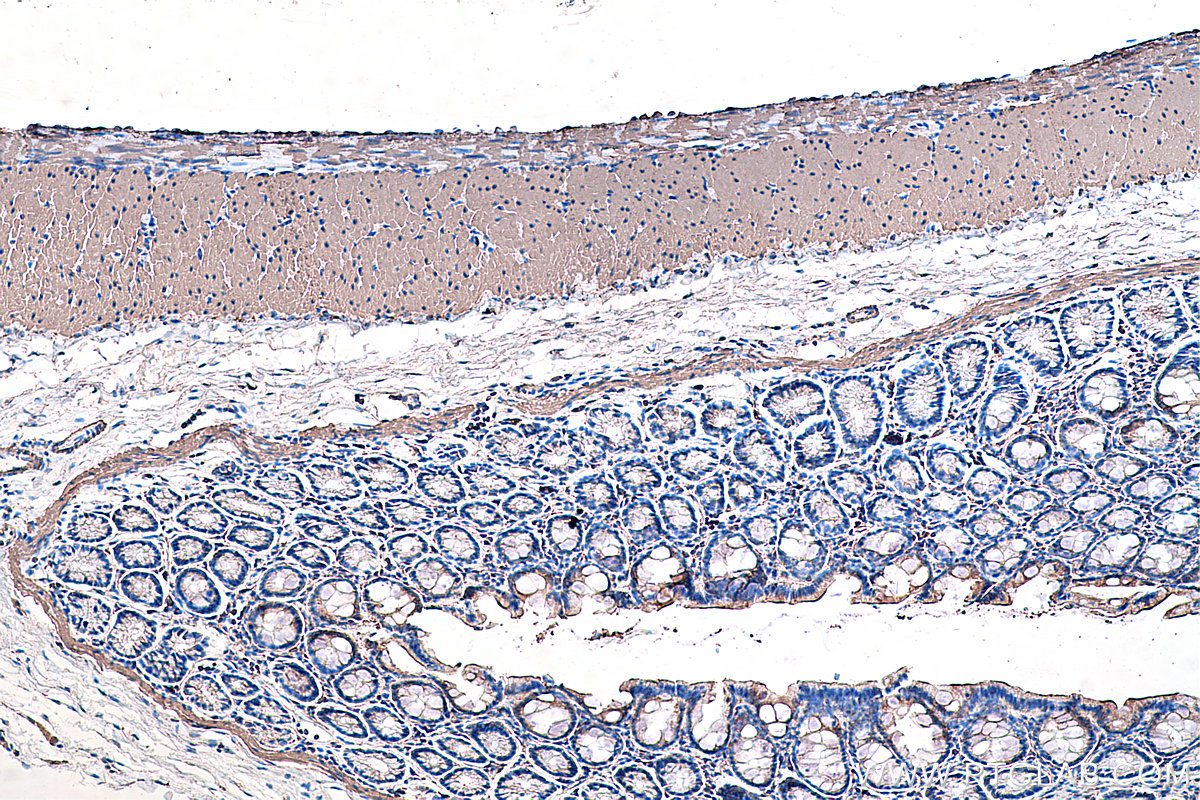 Immunohistochemical analysis of paraffin-embedded rat colon tissue slide using KHC0345 (MYL9 IHC Kit).