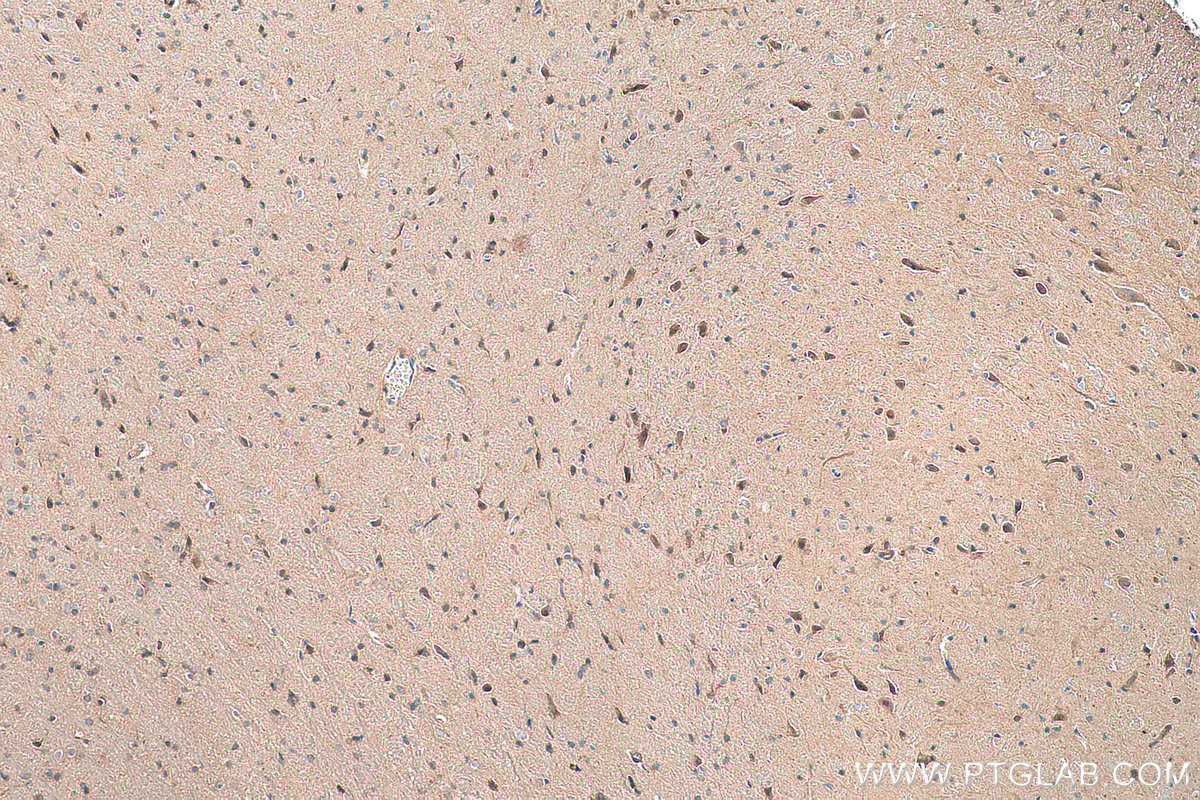 Immunohistochemical analysis of paraffin-embedded rat brain tissue slide using KHC0359 (MYO16 IHC Kit).