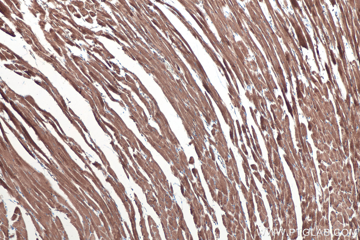 Immunohistochemical analysis of paraffin-embedded mouse heart tissue slide using KHC0360 (MYO18A IHC Kit).