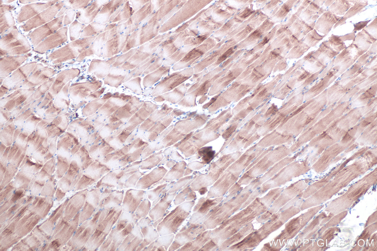 Immunohistochemical analysis of paraffin-embedded rat skeletal muscle tissue slide using KHC0360 (MYO18A IHC Kit).